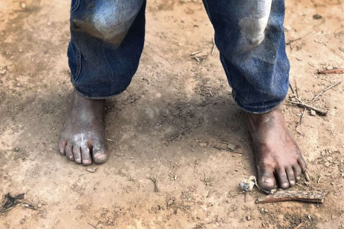 En Chaco, según el último informe de Unicef, la mitad de los chicos de hasta 17 años son pobres. En El Impenetrable, esta situación se agrava y llega a niveles desoladores. la nacion recorrió este bosque de espinas en el que viven 65.000 personas y encontró chicos con desnutrición, que comen una vez