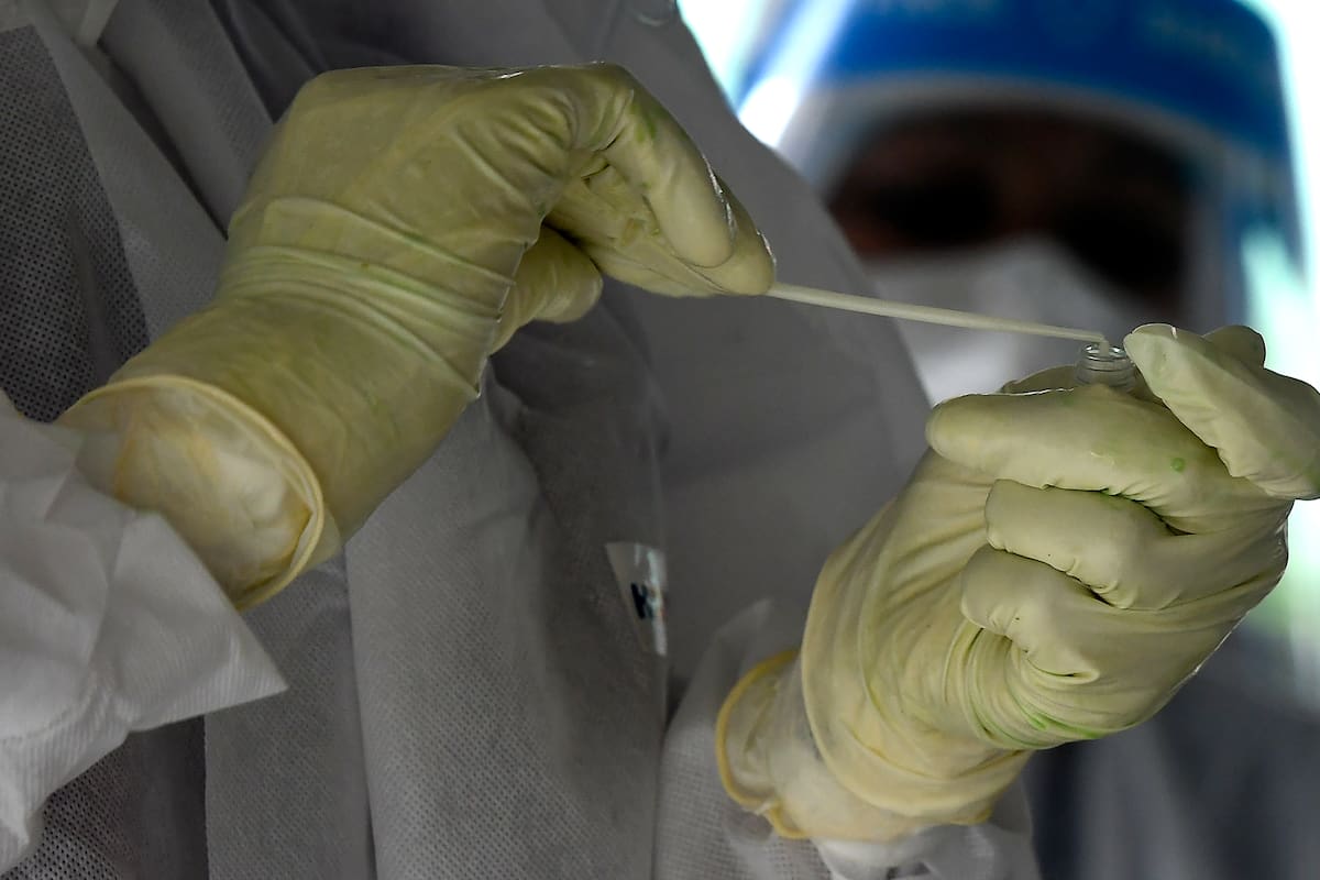 En el caso del coronavirus, el volumen de los anticuerpos cae bruscamente cuando se termina la enfermedad aguda