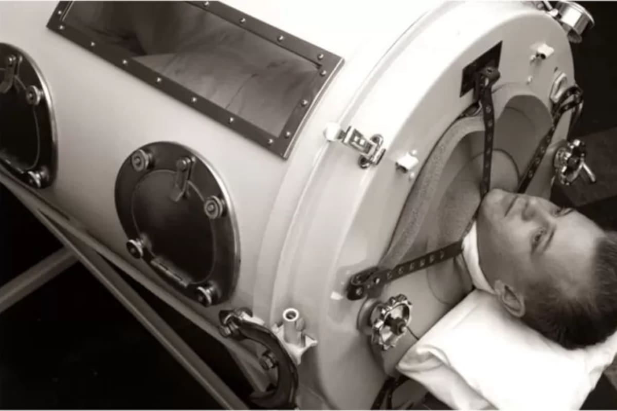 En el siglo pasado, el uso de los pulmones de acero era muy com'un para ayudar a pacientes de polio