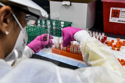 En esta foto de archivo tomada el 13 de agosto de 2020, una técnica de laboratorio clasifica muestras de sangre dentro de un laboratorio para un estudio de la vacuna Covid-19 en los Centros de Investigación de América (RCA) en Hollywood, Florida
