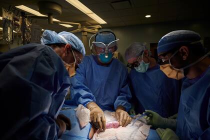 En esta fotografía de septiembre de 2021, facilitada por el centro médico Langone Health de la Universidad de Nueva York, un equipo quirúrgico examina un riñón de cerdo unido al cuerpo de una donadora fallecida para examinar la reacción de rechazo