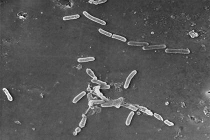 En esta imagen de microscopio electrónico proporcionada por los Centros para el Control y la Prevención de Enfermedades de EEUU se ve la bacteria Pseudomonas aeruginosa con forma de bastón. (Janice Haney Carr/CDC vía AP)