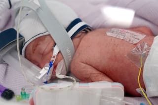 Australiana da a luz a cuatrillizas idénticas después de un embarazo sumamente inusual