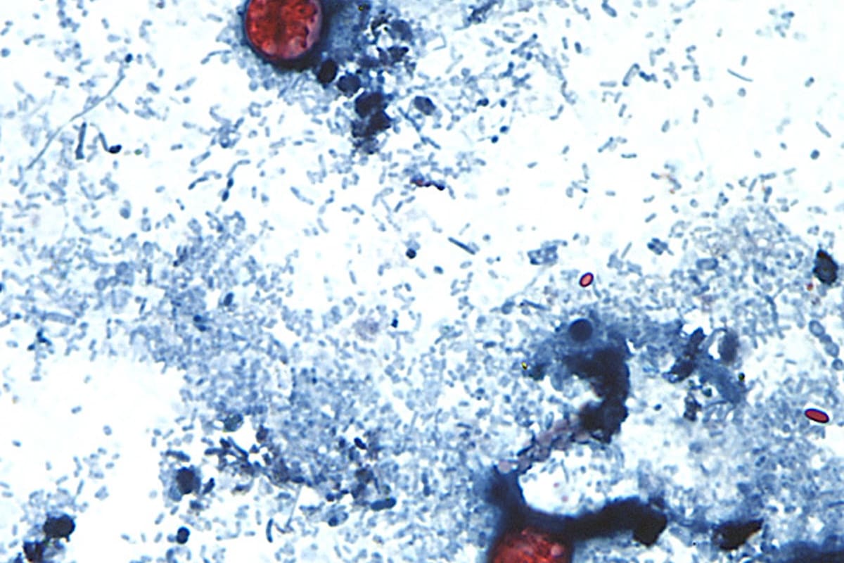 En esta imagen sin fecha, tomada a través de un microscopio y proporcionada por los Centros para el