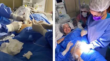 En la izquierda, la médica recibe una aguja mientras le realizan un ultrasonido al feto para encontrar el tumor. En la derecha, Polyana, reccibe la aguja que será utilizada para quemar el tumor