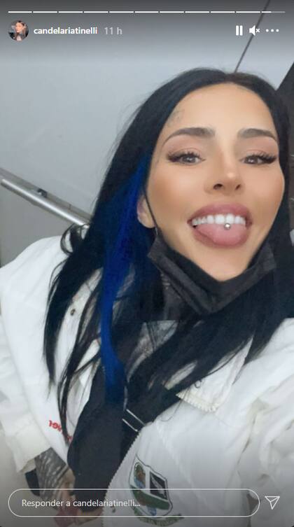 En la última selfie que Cande Tinelli compartió en la noche de este jueves no hay rastros de la herida accidental