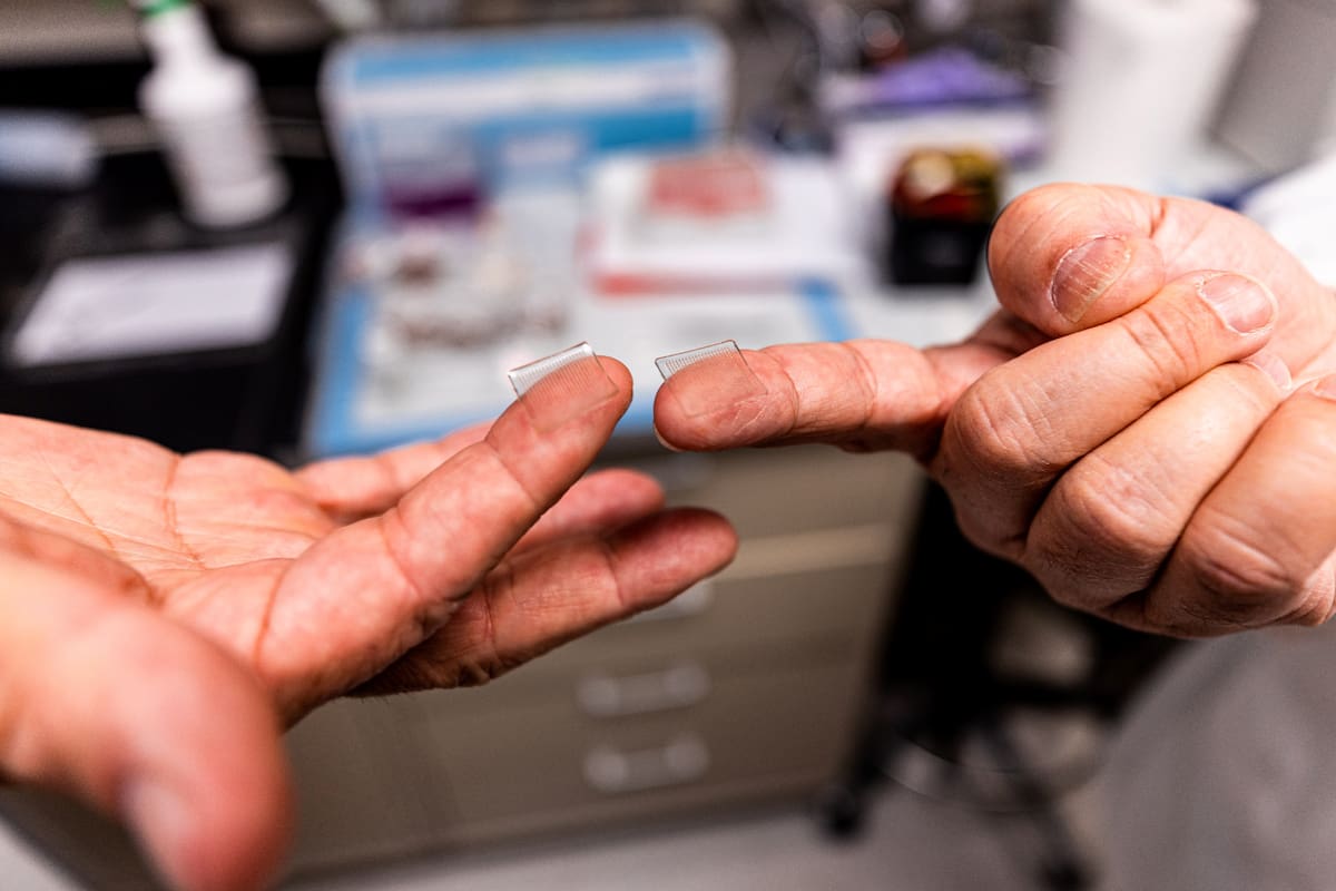 En la Universidad de Pittsburgh, dos investigadores con parches del tamaño de la punta de los dedos con agujas microscópicas solubles, una posible vacuna para el coronavirus
