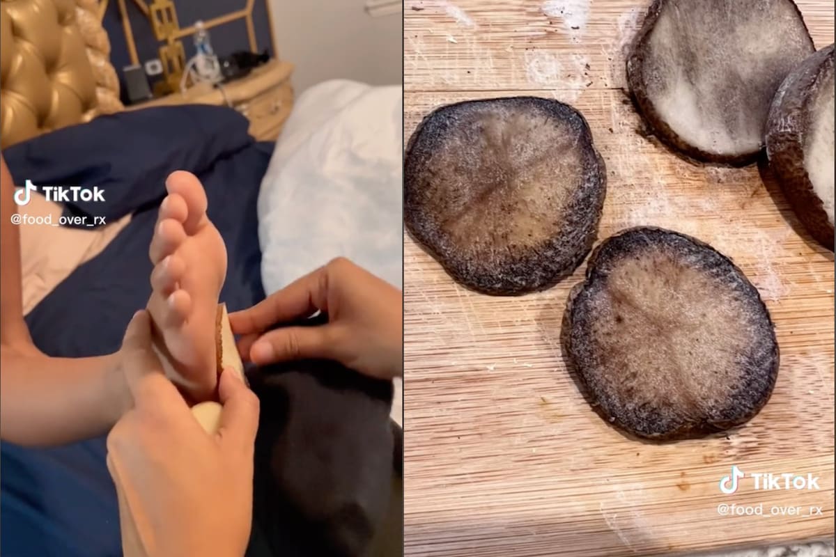 En las redes circulan diversos remedios caseros para aliviar síntomas del resfrío; ¿sirven las papas?