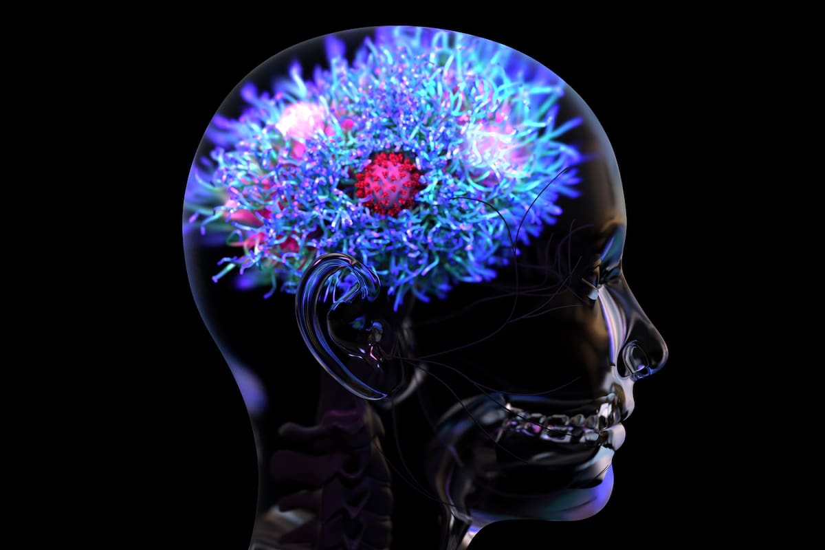 En mayo pasado, un equipo de investigadores de la Universidad de Oxford publicó que una de cada tres personas que tuvo Covid tenía algún problema neurológico o psiquiátrico seis meses después de la infección aguda