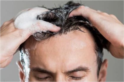 En personas con cuero cabelludo sano, un enjuague de vinagre muy diluido podría probarse de manera ocasional con fines cosméticos