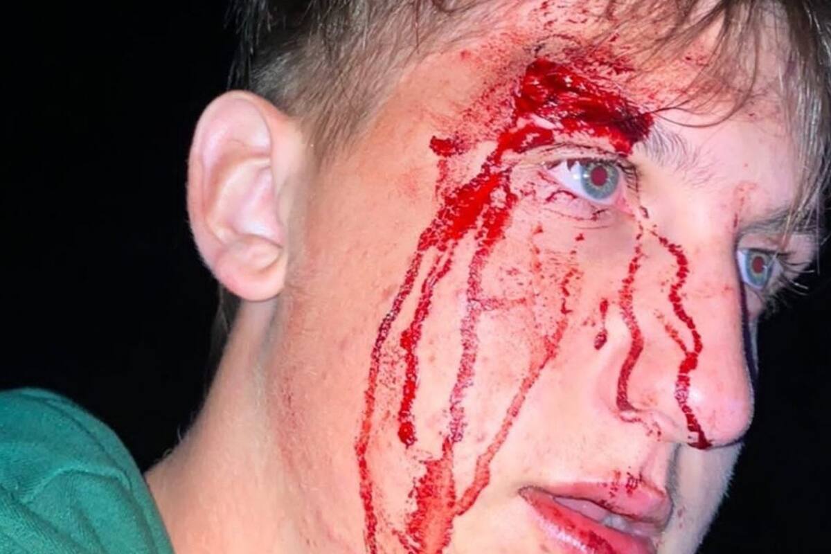 En Pinamar: un grupo de jóvenes denunció que patovicas de un boliche los atacaron a golpes y patadas