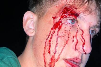 En Pinamar: un grupo de jóvenes denunció que patovicas de un boliche los atacaron a golpes y patadas