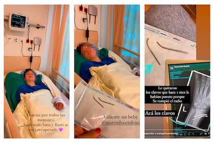En tres historias de Instagram, Anderson mostró el resultado de la operación de su hijo mayor Bastian