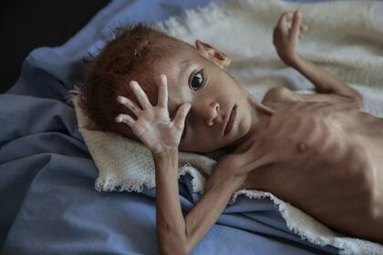 En un estudio publicado el miércoles, la ONG Save The Children estimó que unos 85.000 niños murieron por hambre o enfermedades desde la intensificación de la guerra en Yemen en 2015