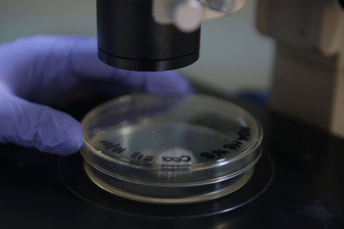 En un laboratorio del Ibyme develaron porqué no es efectivo en muchos casos el tratamiento contra un tipo de tumores de mama