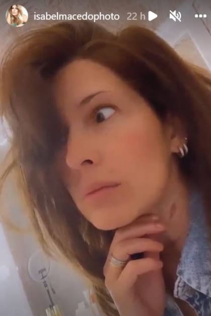 En una publicación reciente, Isabel Macedo mostró nuevamente su marca en el cuello