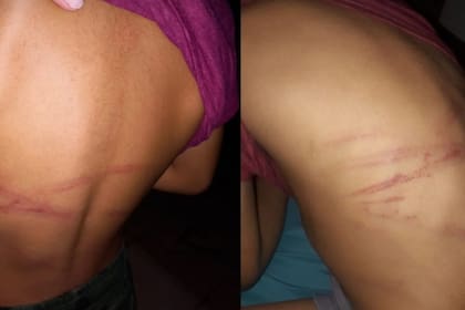 Enzo, un niño de siete años fue brutalmente golpeado por su madre, Rocío F. en Posadas