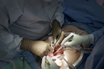 Equipo de profesionales durante una cirugía de alta complejidad en un quirófano con soporte tecnológico especializado