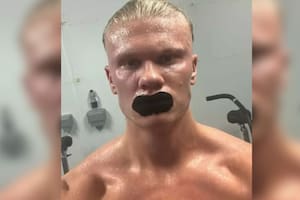 Erling Haaland reveló por qué se "venda" la boca para dormir