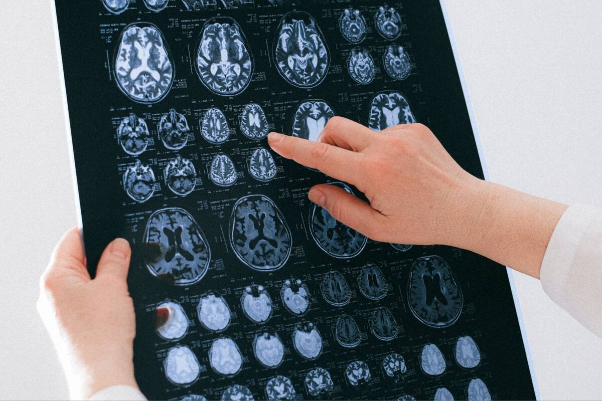 Es cierto que el cerebro humano es inusualmente grande (Foto ilustrativa: PEXELS)