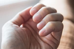 Es importante prestar atención a los cambios de color y la aparición de manchas en las uñas