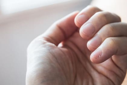 Es importante prestar atención a los cambios de color y la aparición de manchas en las uñas