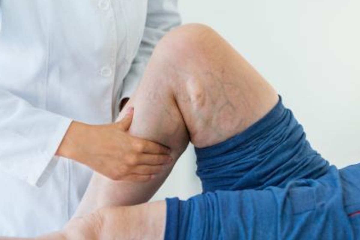 Es importante visitar al médico ante la presencia de síntomas
