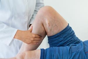 Es importante visitar al médico ante la presencia de síntomas