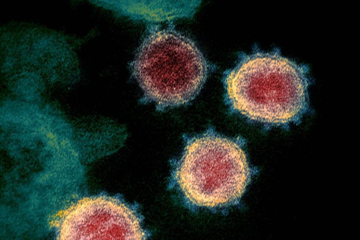 Es muy poco probable que las personas que han tenido Covid-19 lo contraigan de nuevo durante al menos seis meses después de su primera infección, según un estudio británico de trabajadores de la salud en la primera línea contra la pandemia