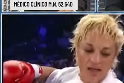 Es vital controlar la presión arterial para evitar un ACV