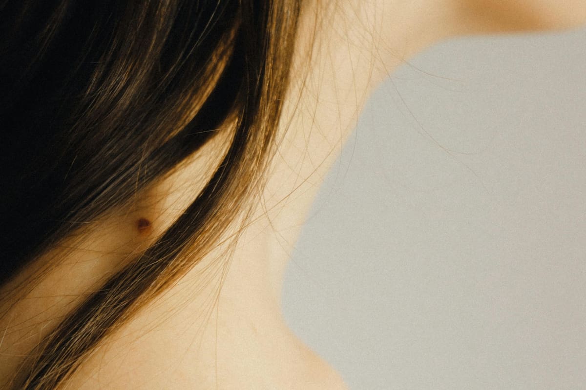 Esta acumulación de tejido adiposo o pérdida de firmeza en la zona del mentón es una de las preocupaciones estéticas más frecuentes