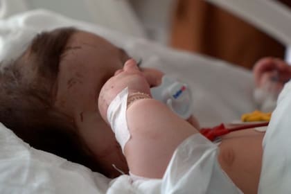 Esta bebé de seis meses, cuya cara está cubierta de cicatrices, solo es conocida como "anónima" por su etiqueta.