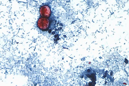 Esta fotografía tomada a través de un microscopio y difundida por los CDC muestra Cyclospora cayetanensis oocysts de una muestra de heces