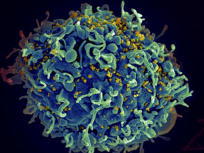 Esta imagen coloreada de microscopio electrónico proporcionada por los Institutos Nacionales de Salud muestra una célula T humana, en azul, atacada por virus VIH, en amarillo, que causa el sida