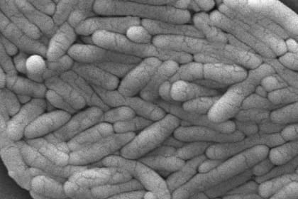 Esta imagen de 2009 tomada con microscopio electrónico, provista por los Centros de Control y Prevención de Enfermedades, muestra un cúmulo de bacterias Gram-negativas Salmonella typhimurium aislado de un cultivo puro. (Janice Haney Carr/CDC via AP)