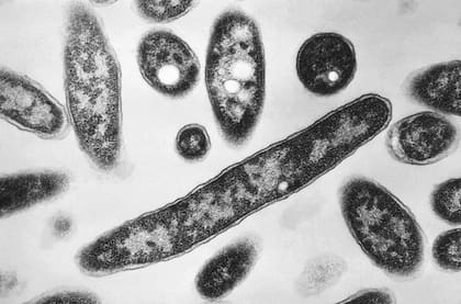 Esta imagen tomada por microscopio electrónico y distribuida por los Centros de Control y Prevención de Enfermedades, muestra la bacteria Legionella pneumophila, causante de la legionelosis, una enfermedad pulmonar. (Francis Chandler/CDC via AP, File)