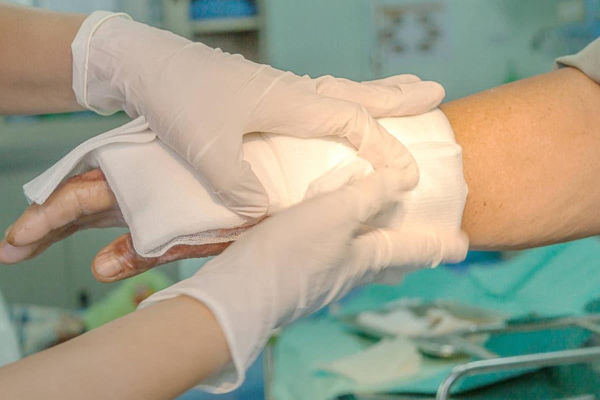 Estas son algunas precauciones y acciones que debe tomar para disminuir el impacto de una quemadura