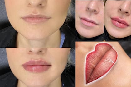 Estas son las imágenes del "antes y después" publicadas en el sitio oficial de la clínica estética (Foto absaesthetic.org)