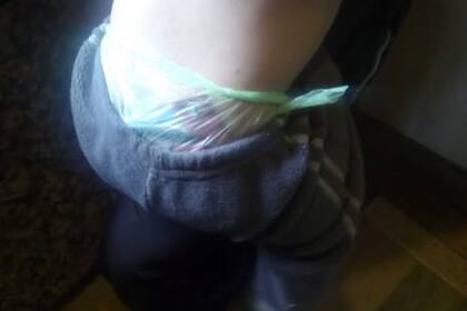 Este pequeño bebé tiene un año y medio y usa bolsas en vez de pañales porque su madre no puede comprarlos.