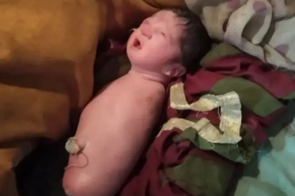 Este trastorno afecta a uno de cada 100.000 recién nacidos. Fuente: SWNS