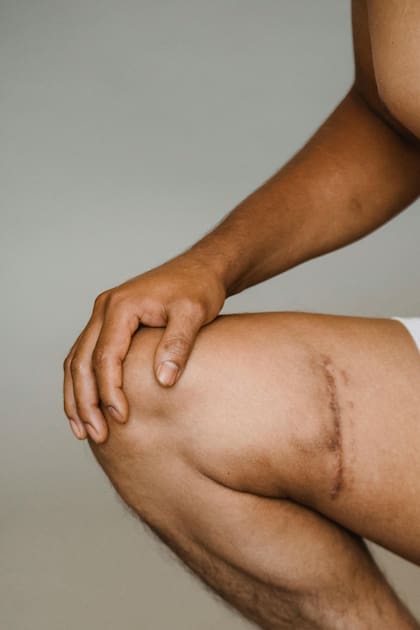 Estiramiento de isquiotibiales y movilidad de rodilla: esencial para corredores y deportistas (FOTO ilustrativa: PEXELS)