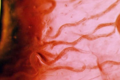 Estos son los C. elegans que iban a bordo y que, a pesar de todo, sobrevivieron