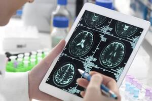 Estudios científicos demostraron cambios en el cerebro en pacientes que tuvieron Covid-19