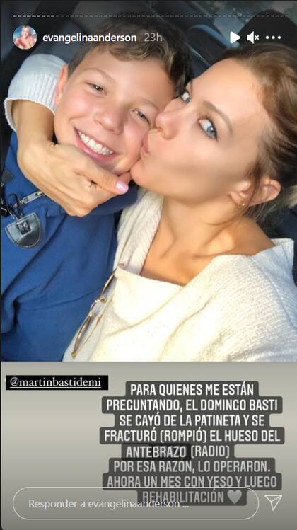Evangelina contó que Bastian tuvo que ser operado tras una fractura de radio al caerse de la patineta