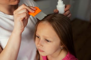 Existen diferentes remedios caseros recomendados por pediatras para combatir los piojos y las liendres en niños