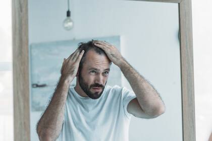 Existen diferentes tipos de alopecias
