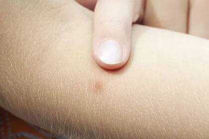 Existen más de 2500 especies de mosquitos, los cuales son transmisores de enfermedades tan perjudiciales como la malaria.