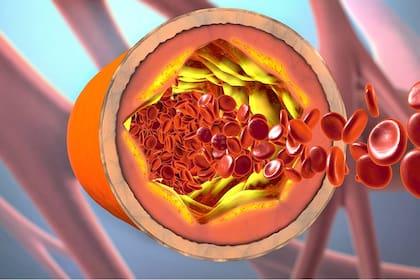 Existen tres fracciones conocidas de colesterol: el bueno, el malo y el feo