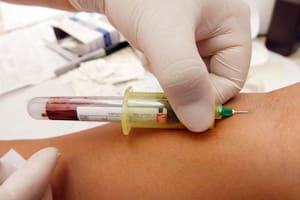 Extracción de sangre para hacer análisis de VIH