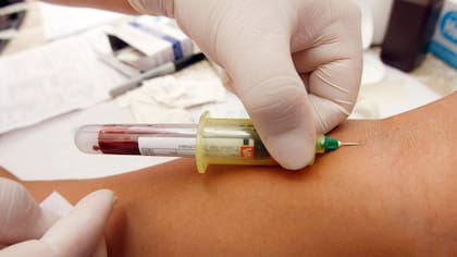 El plasma rico en plaquetas se utiliza para rejuvenecer la piel